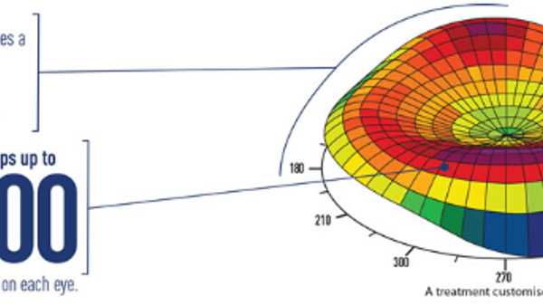 New technology: CONTOURA™ Vision - Personalise Your Eyes