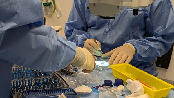 Ground Breaking Artificial Iris Surgery Restores Patient's Vision