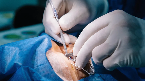 How High is the LASIK Success Rate? Key Statistics Explained
