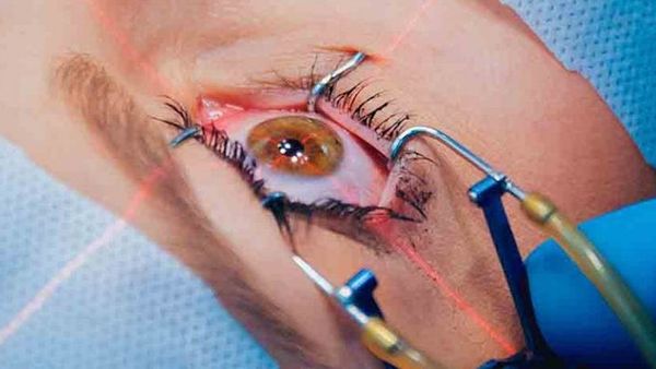 Why People Get Laser Eye Surgery
