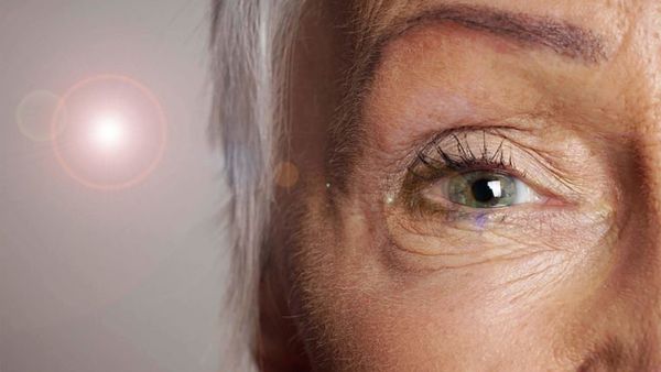5 Facts About Age-Related Macular Degeneration