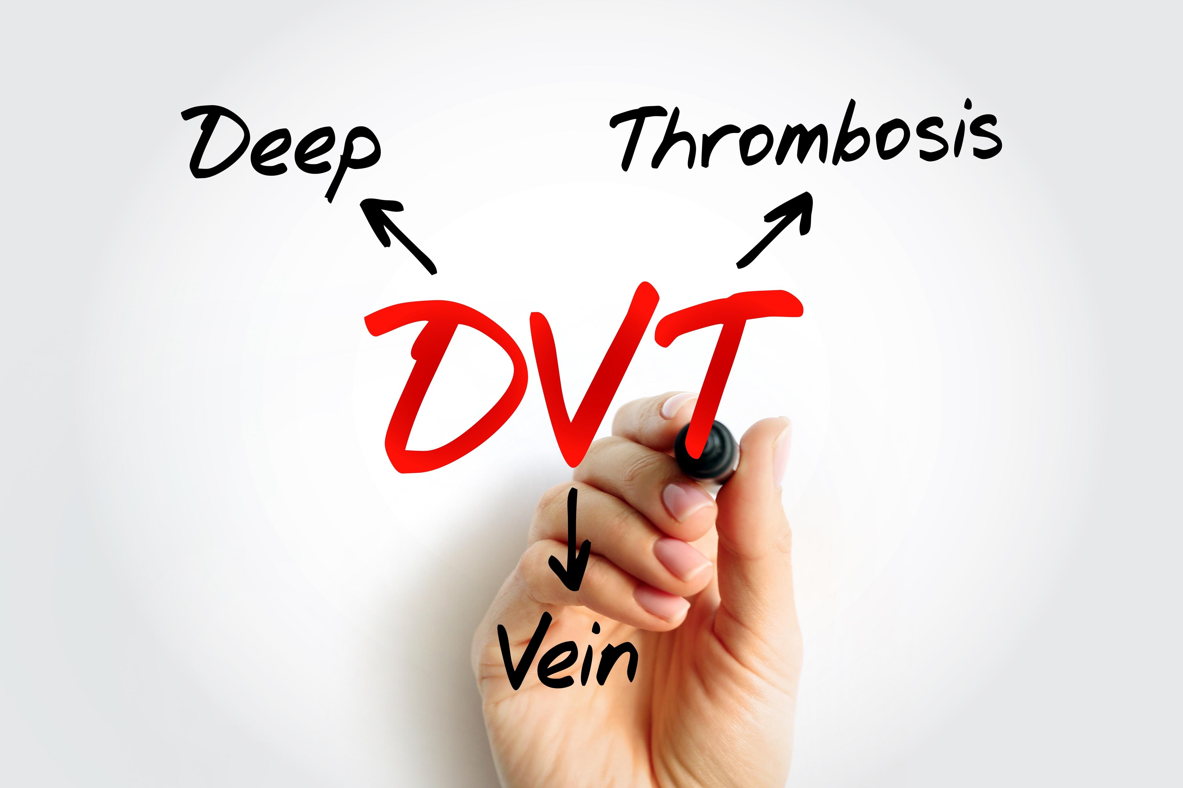 Preventing Deep Vein Thrombosis (DVT) – Tips for Long Flights ✈️