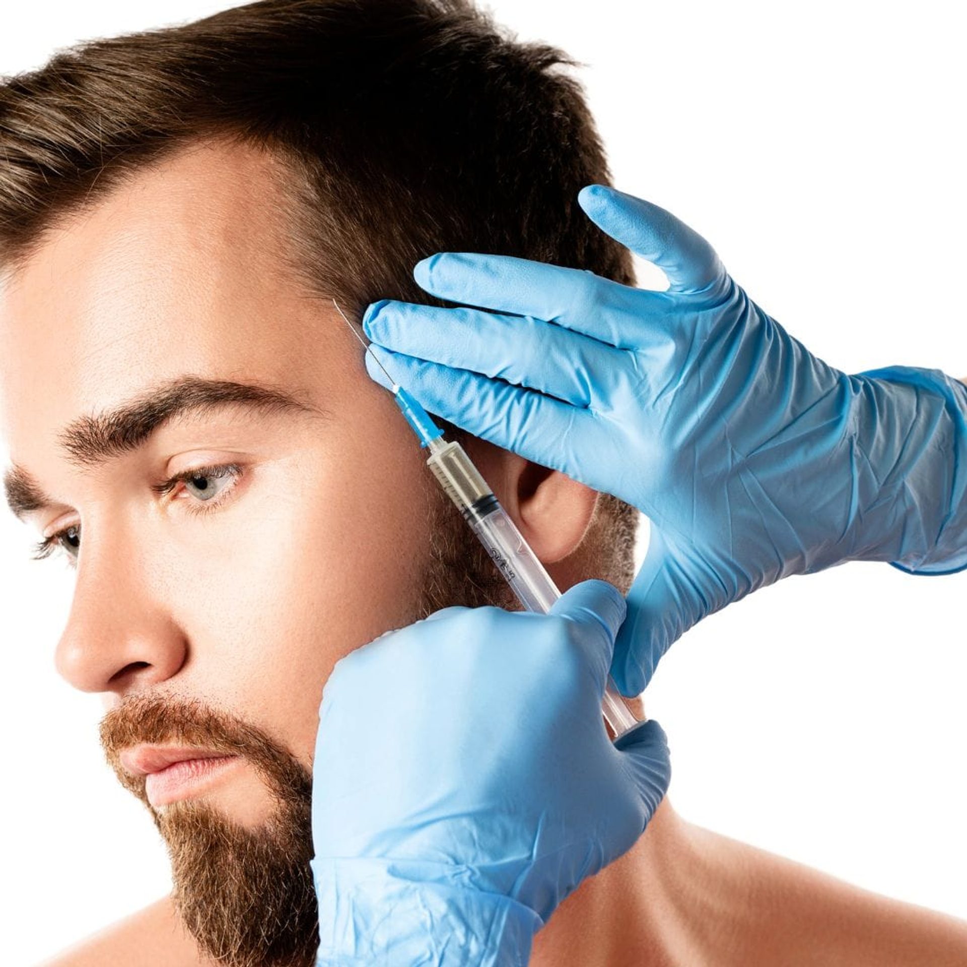 A man receiving a hair mesotherapy injection at the temple