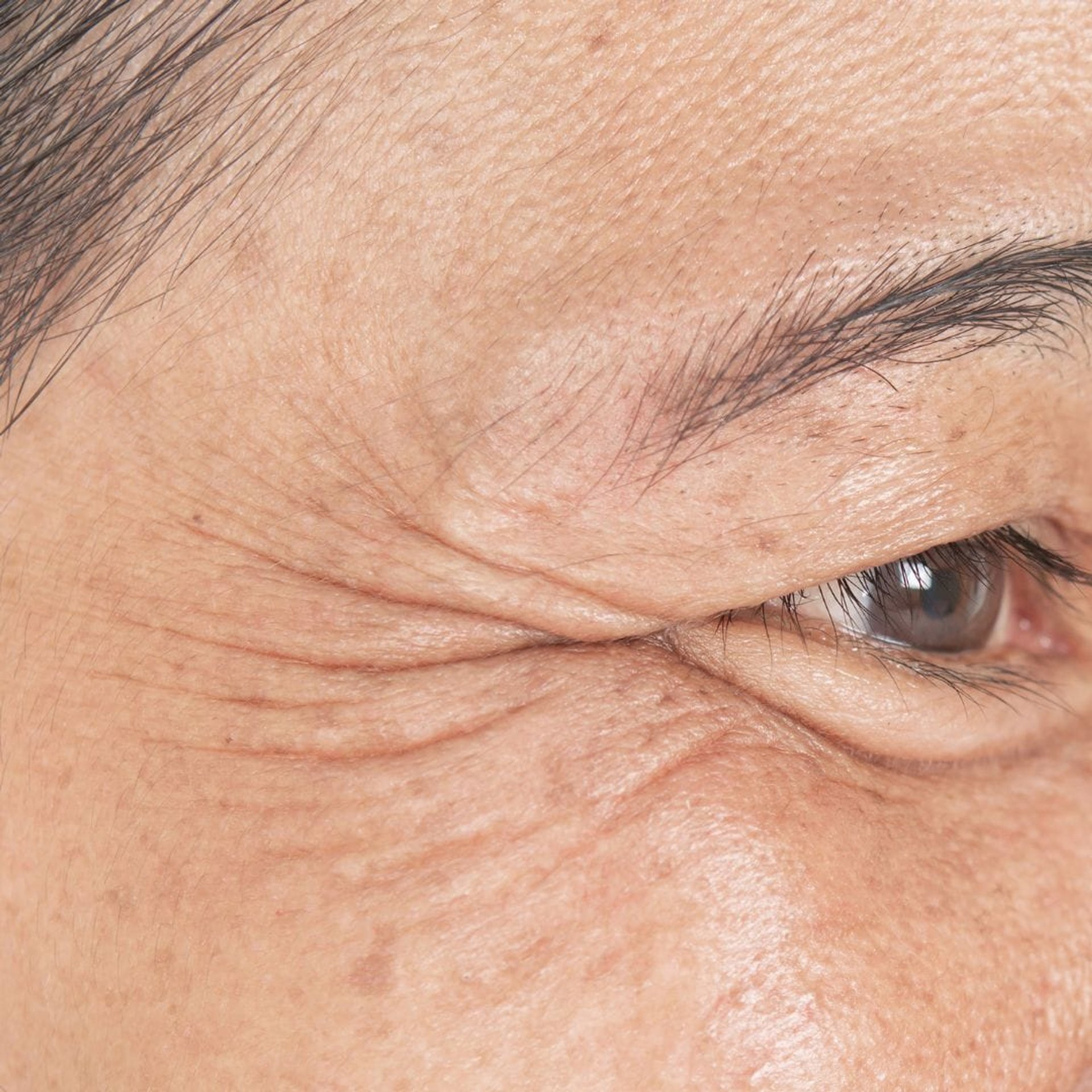 Eye Rejuvenation at Healthy Look Aesthetic, Ubud