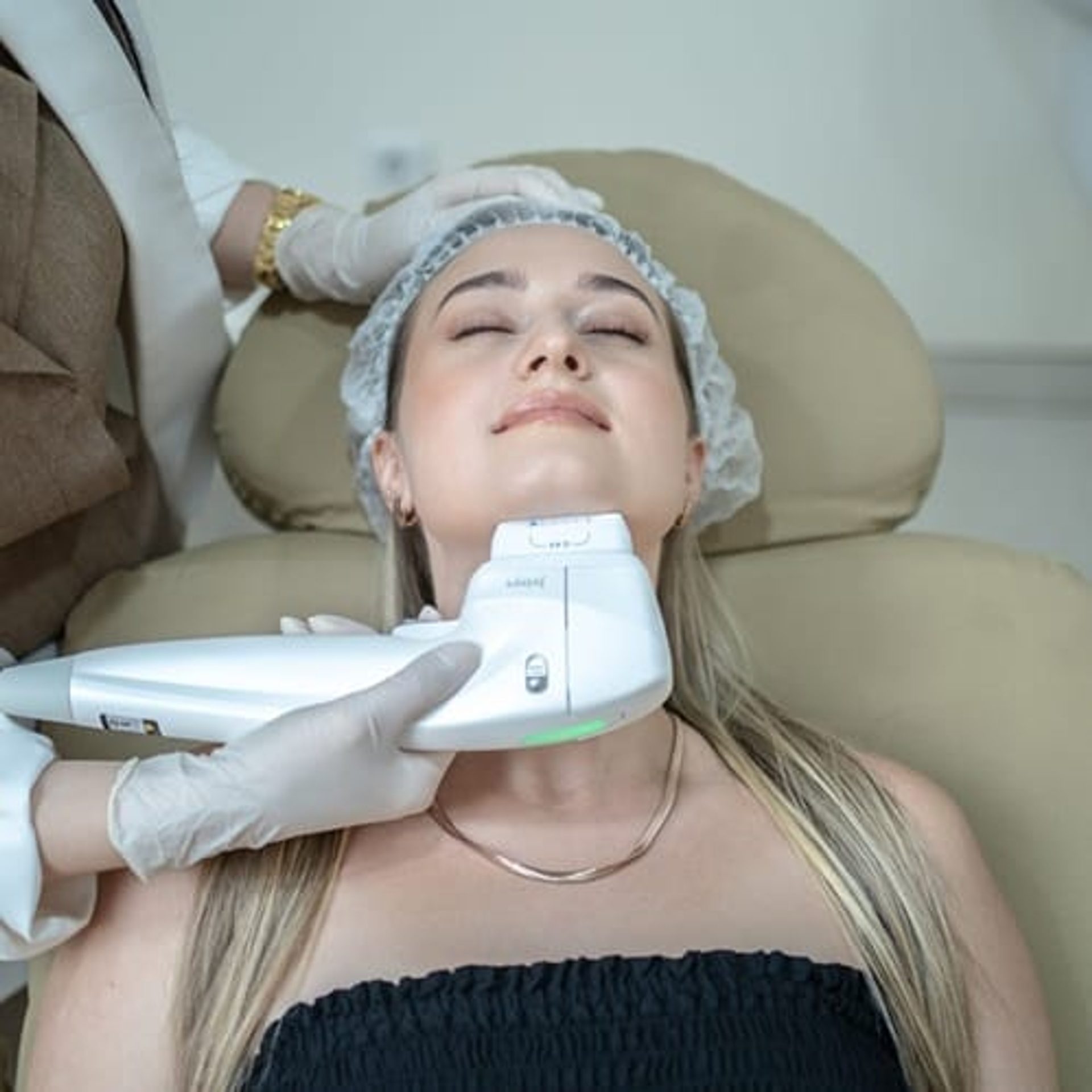 Linear Z HIFU treatment along a patient's neck and jawline