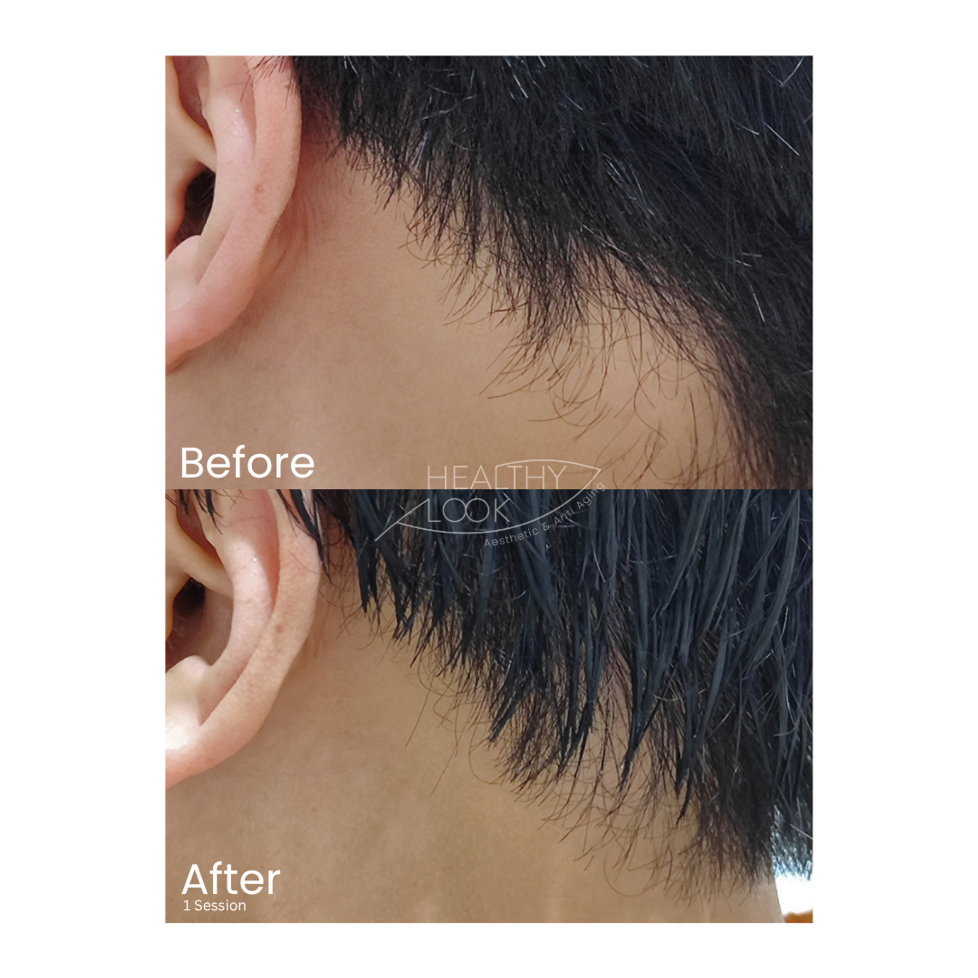 Before and after Hair Treatment at Healthy Look Aesthetic, Ubud