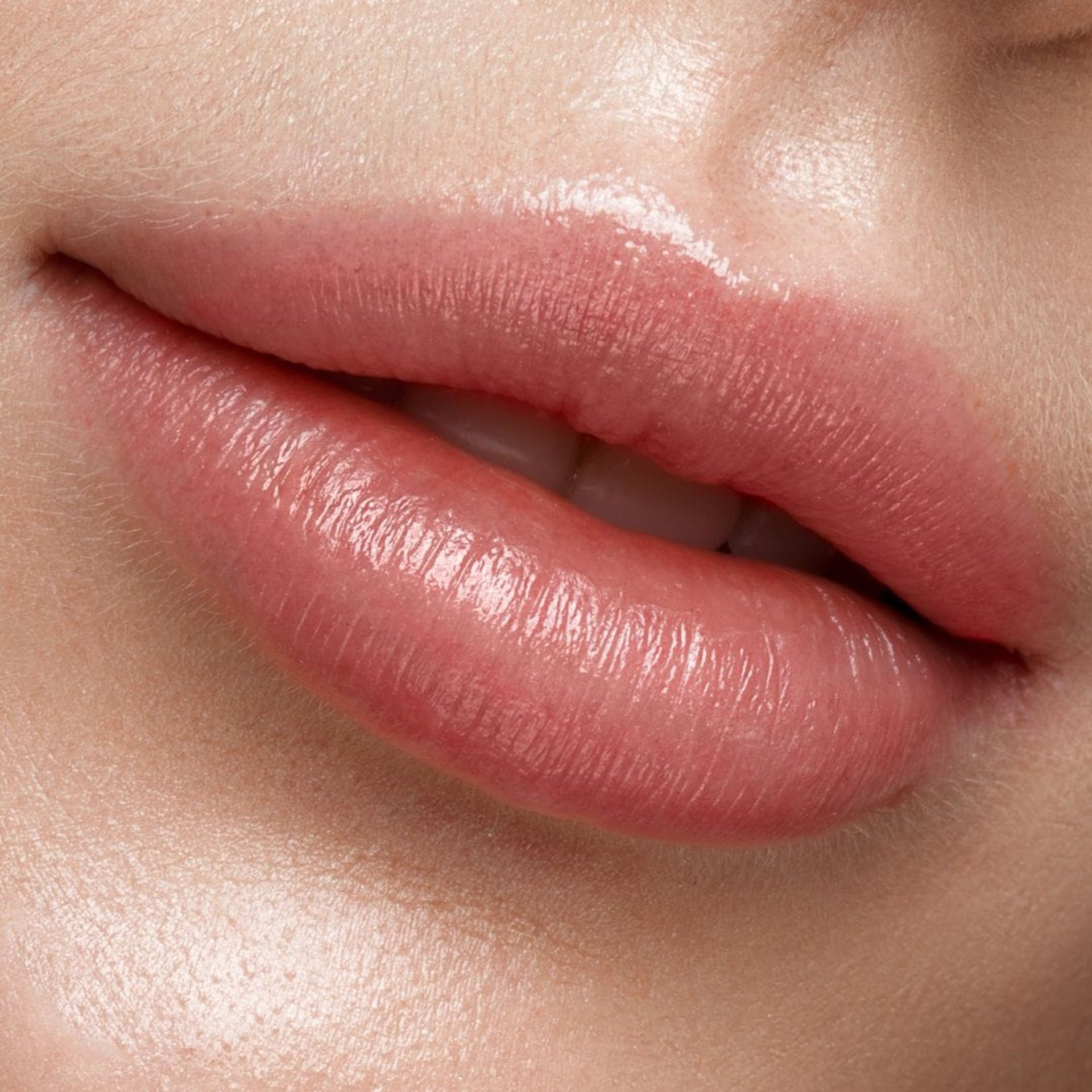 Lip Filler at Healthy Look Aesthetic, Ubud