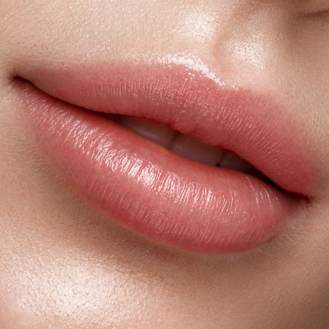 Lip Filler at Healthy Look Aesthetic, Ubud