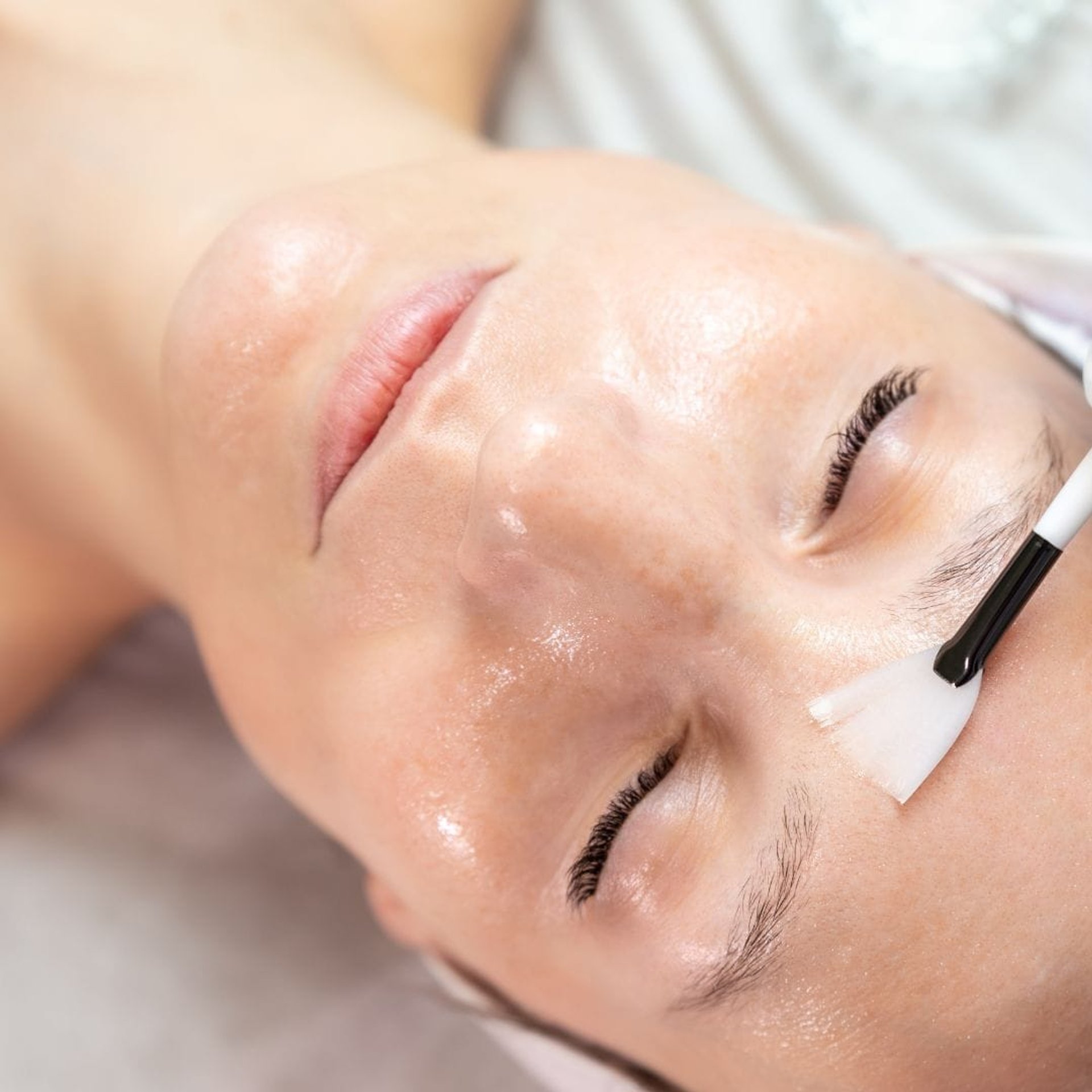 Chemical Peeling at Healthy Look Aesthetic, Ubud
