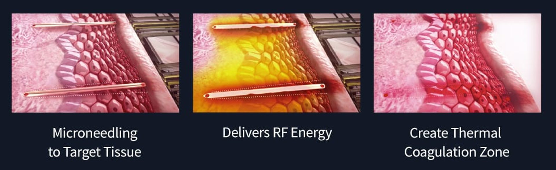 How Sylfirm works?