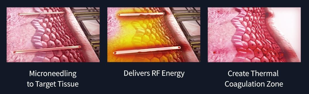 How Sylfirm works?
