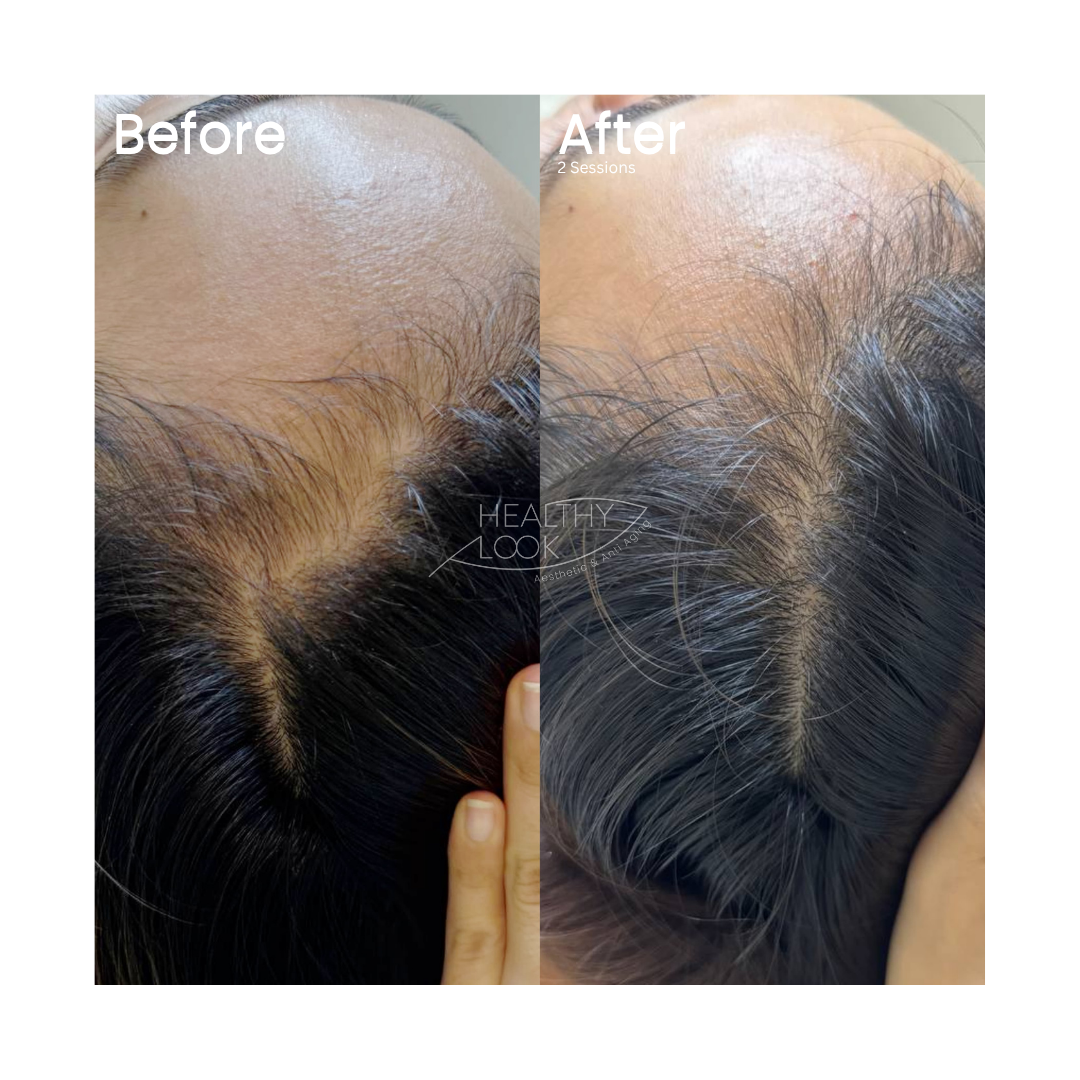 Before and after Hair Treatment at Healthy Look Aesthetic, Ubud