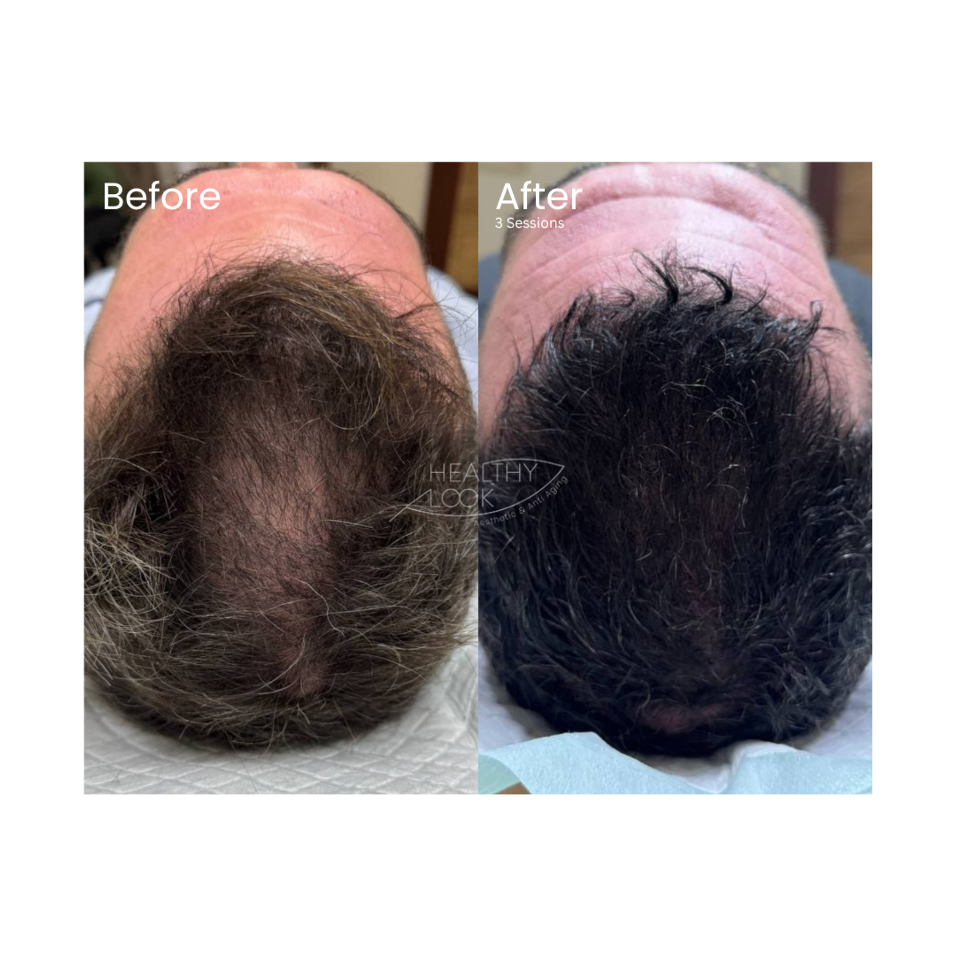 Before and after Hair Treatment at Healthy Look Aesthetic, Ubud