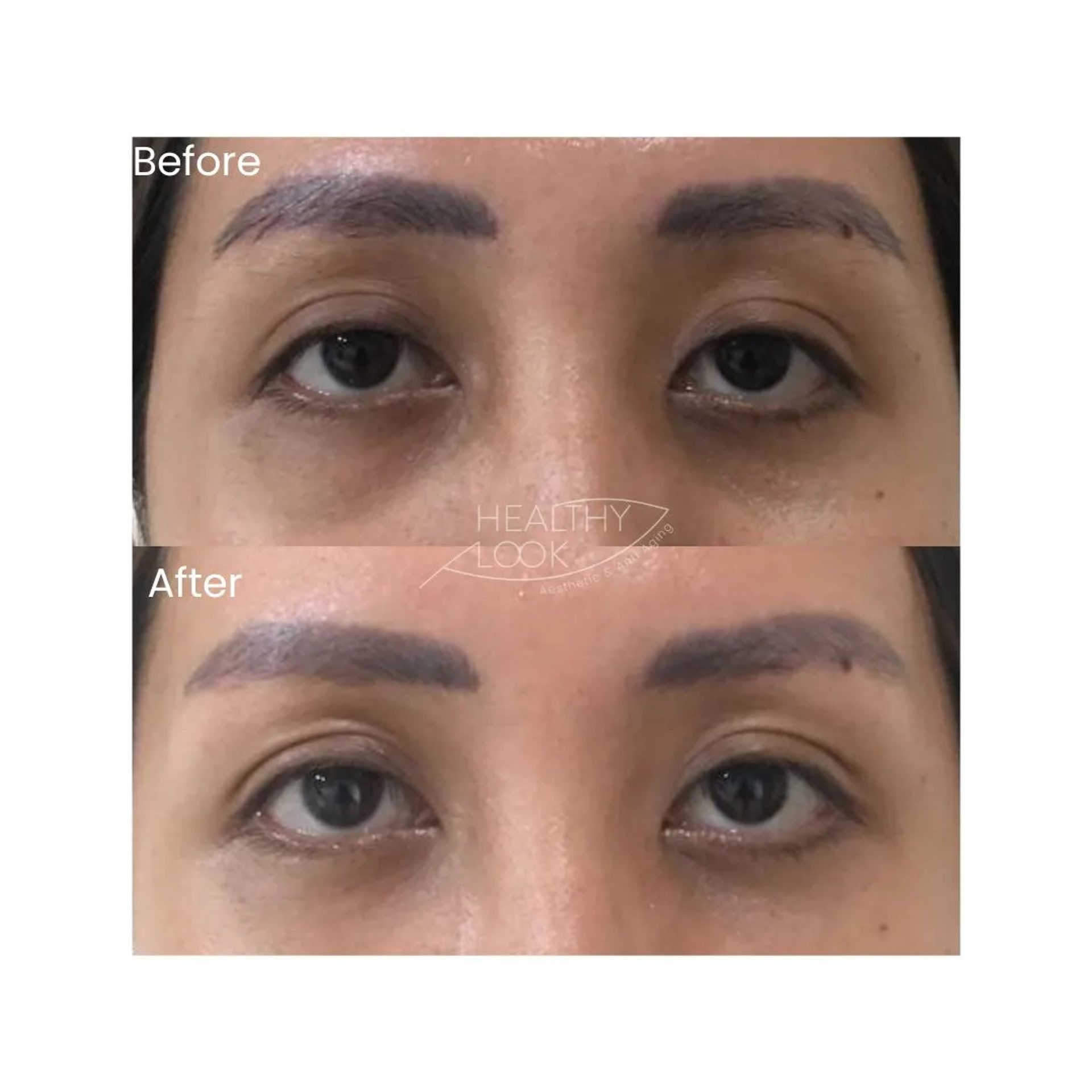 Hair & Skin Treatment before and after result