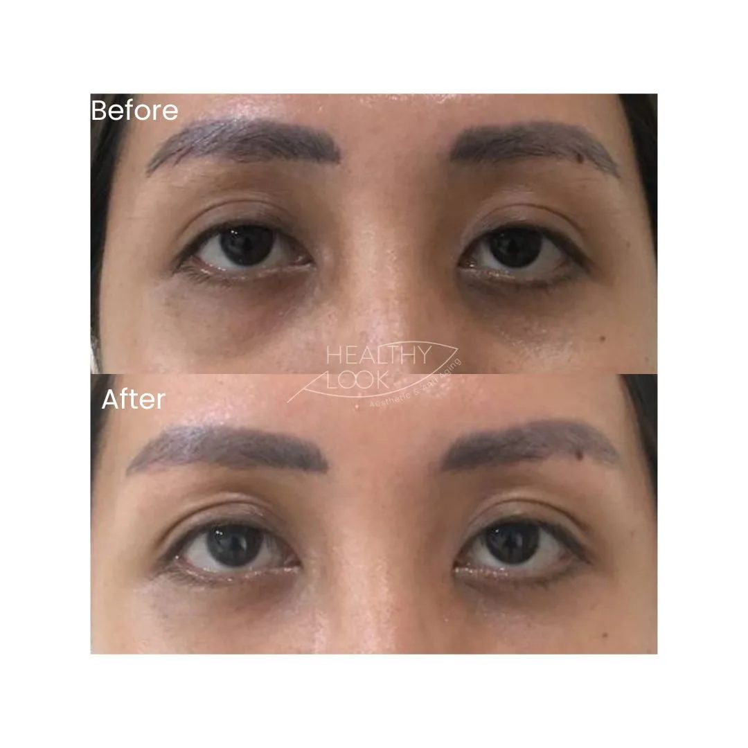 Hair & Skin Treatment before and after result