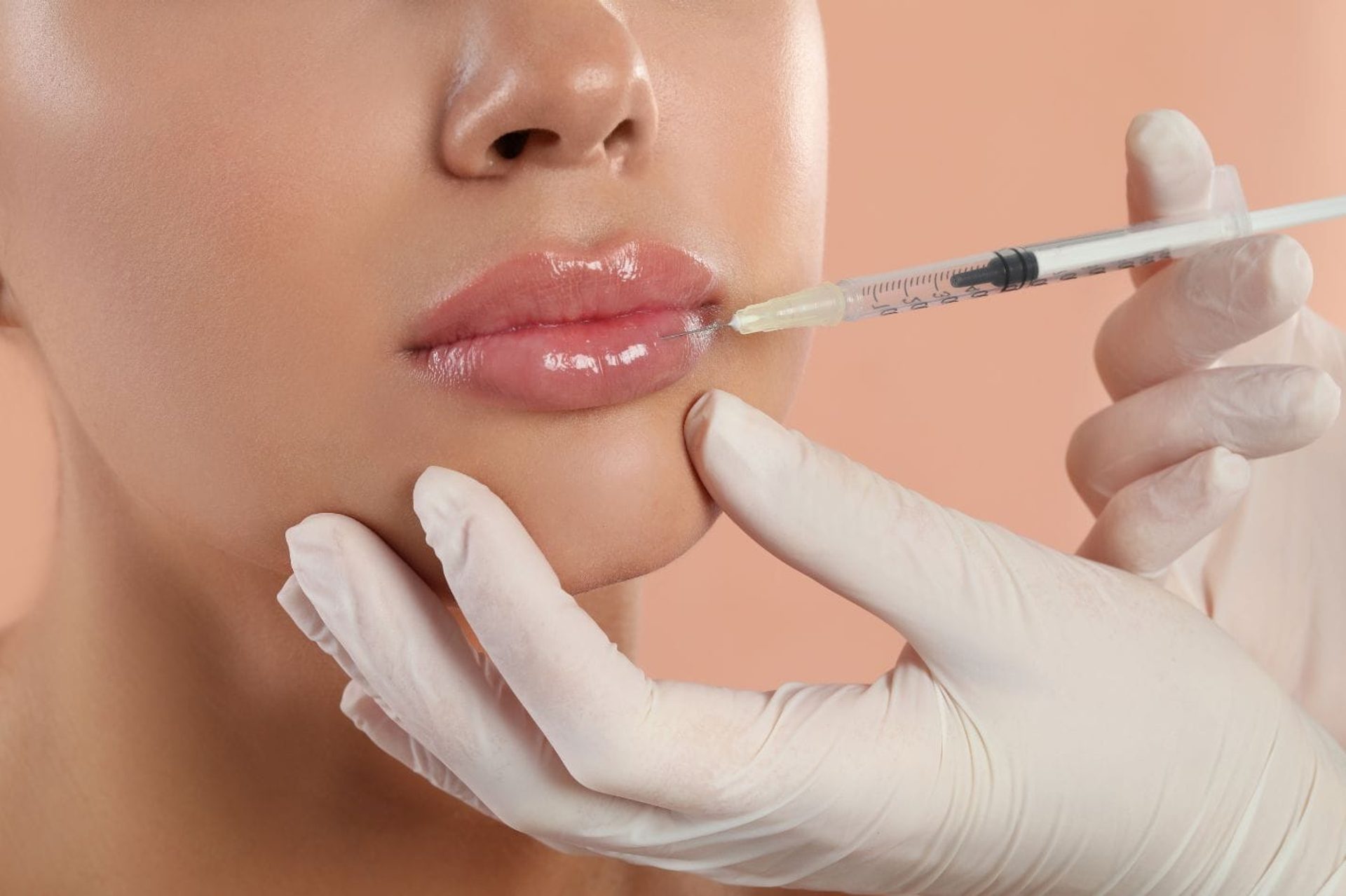 Lip filler injection