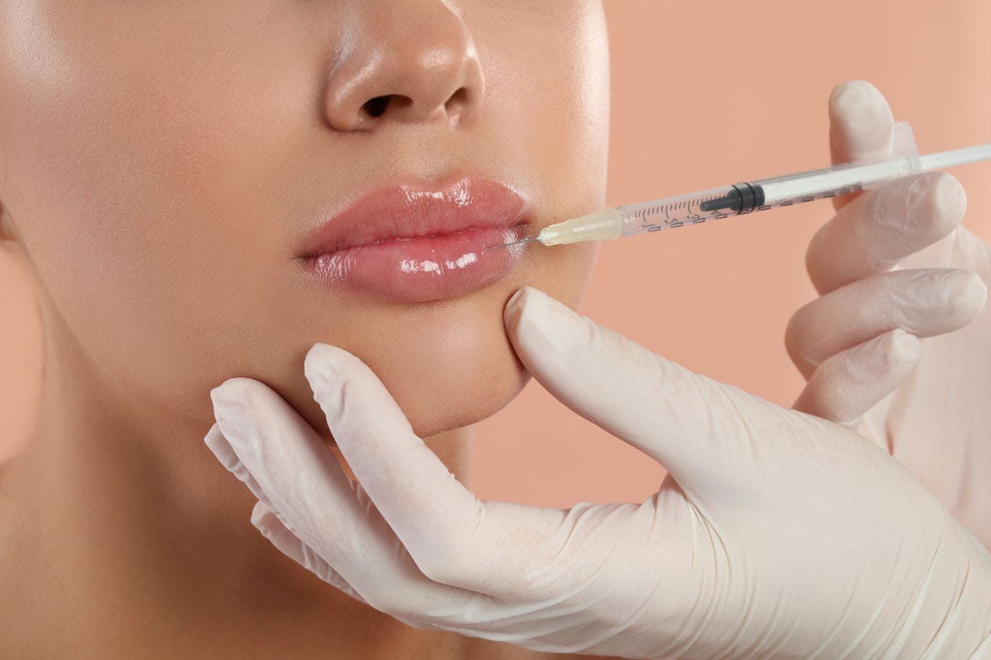 Lip filler injection