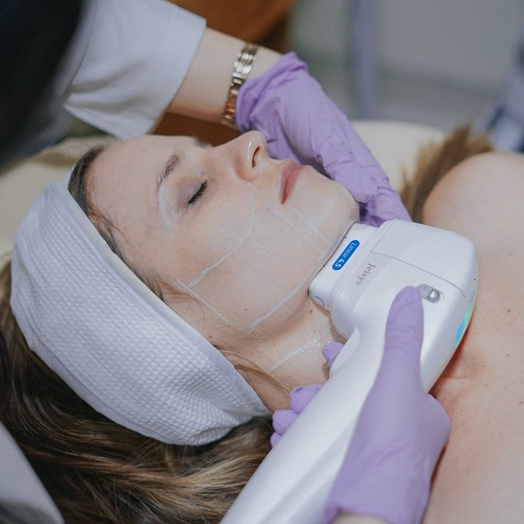 A doctor performing a HIFU treatment at Healthy Look Aesthetic