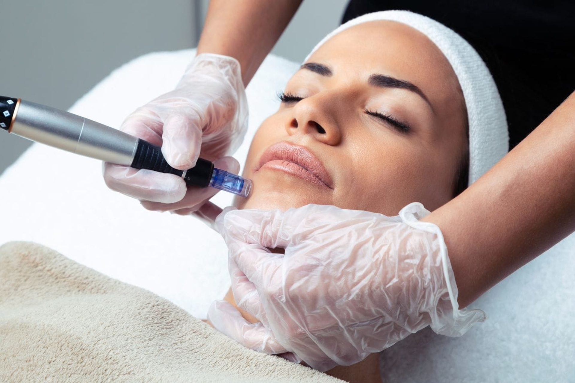 Microneedling pen treatment on the face