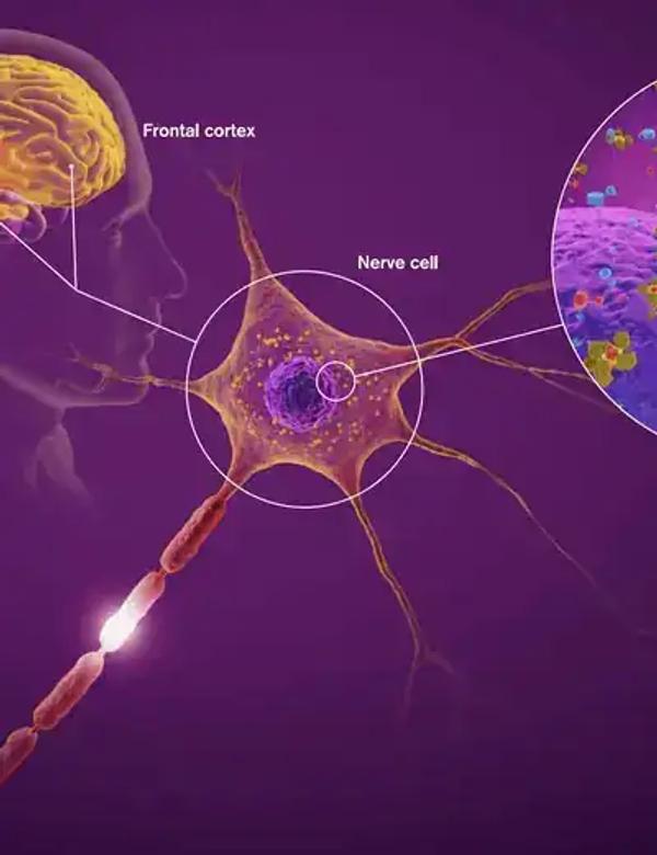 Alzheimer's pill from Australian biotech Actinogen offers hope