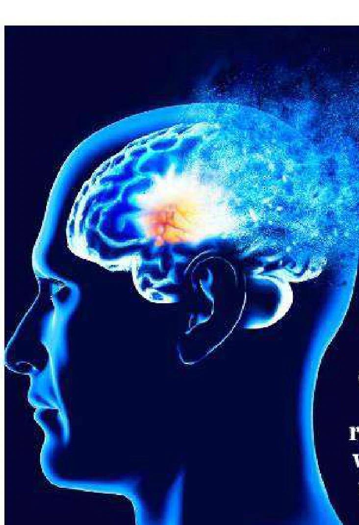 Illustration of a brain used with the Herald Sun report on Actinogen's Alzheimer's drug