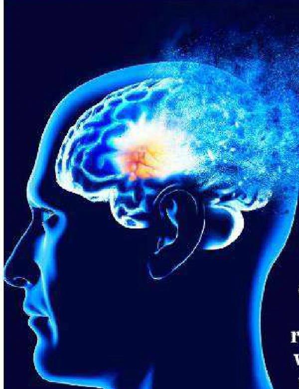 Illustration of a brain used with the Herald Sun report on Actinogen's Alzheimer's drug