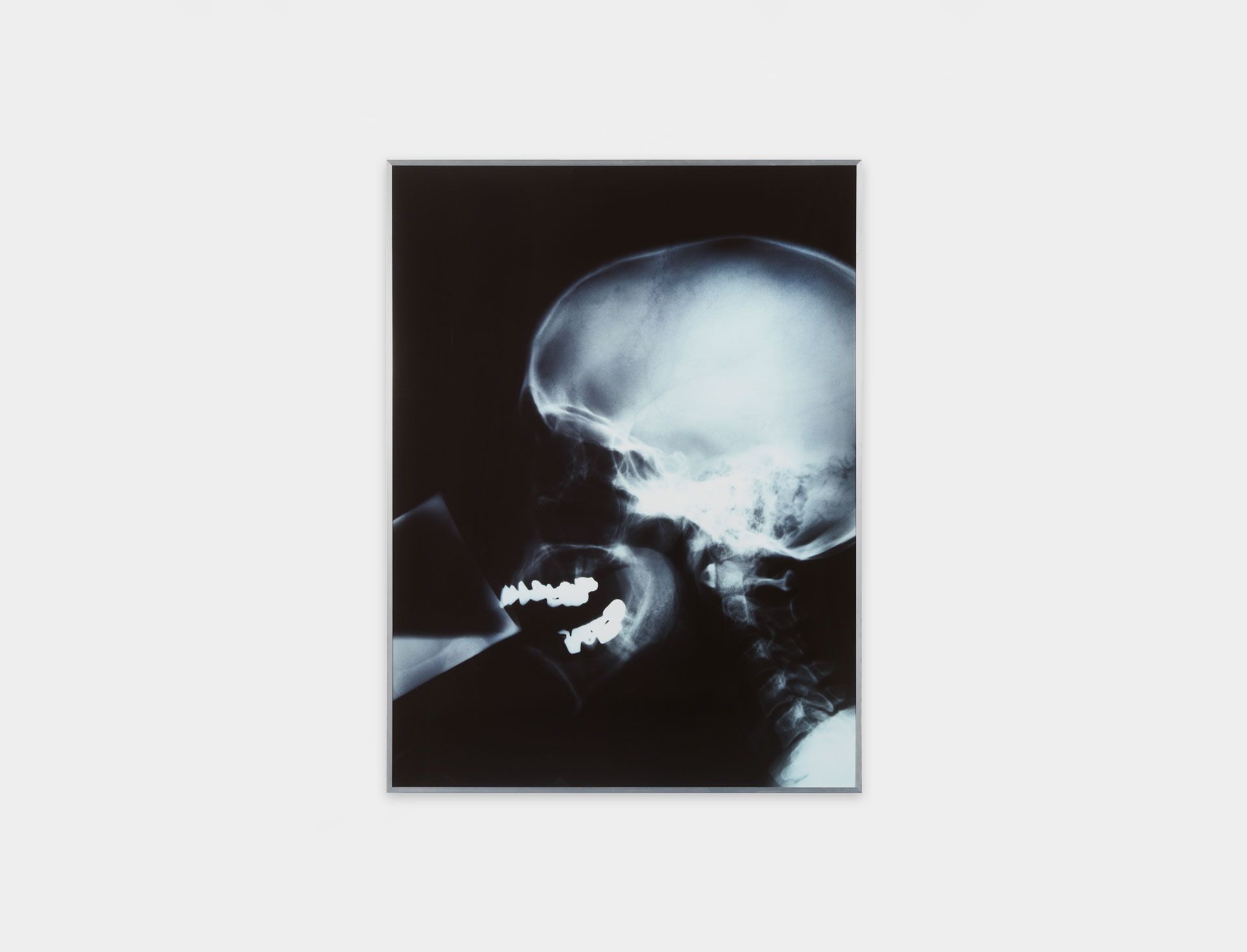 A photograph by Isa Genzken, titled X-Ray, dated in 1991 and 2012.