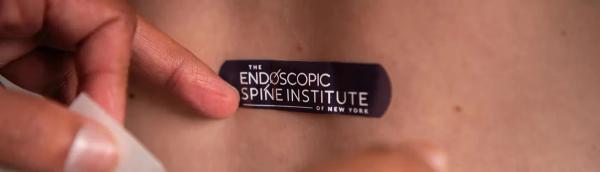 Who Is a Candidate for Endoscopic Spine Surgery? | ESINY