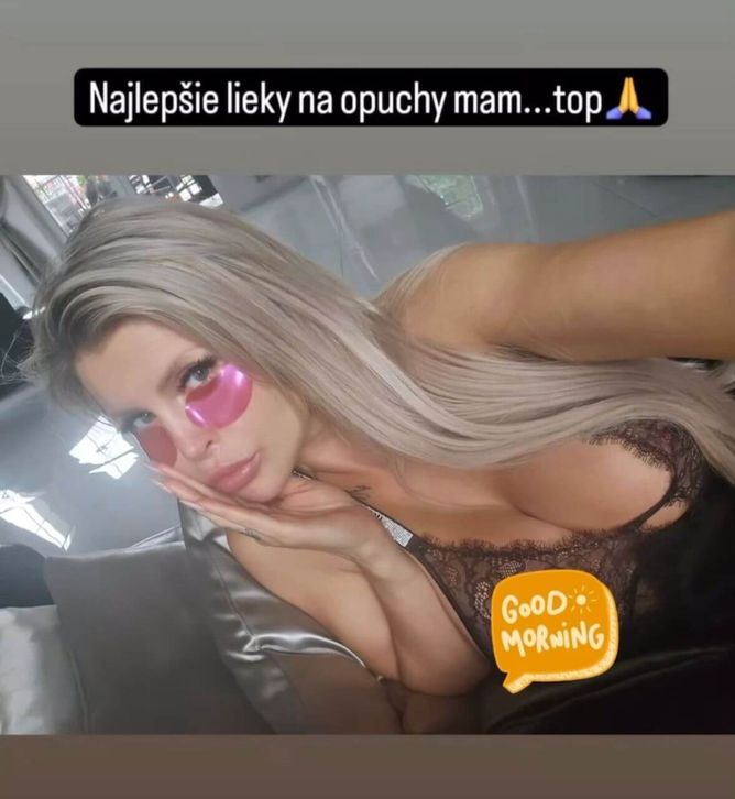 Lela Vémola má za sebou další operaci. Lela Vémola má za sebou další operaci.