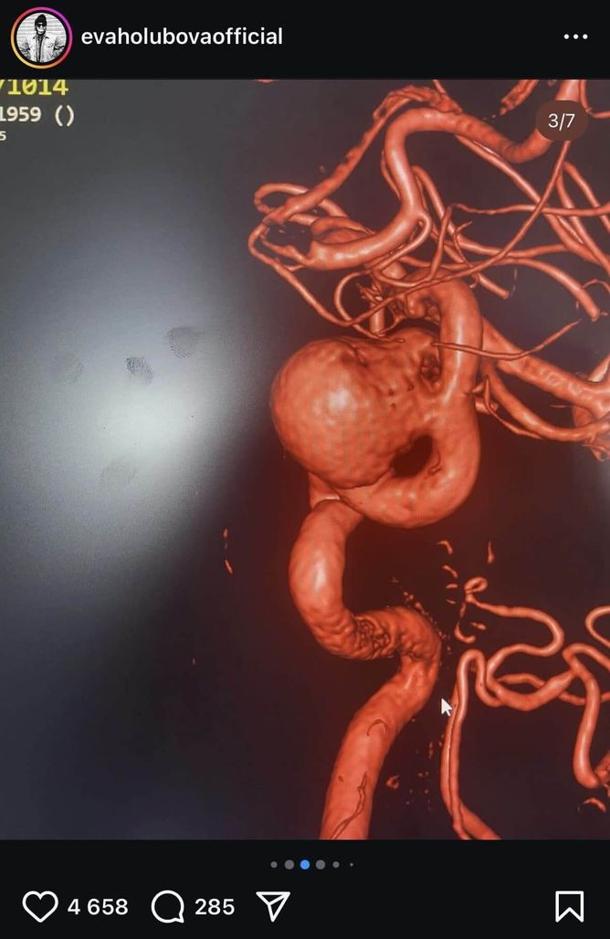 Eva Holubová půjde na operaci Eva Holubová půjde na operaci