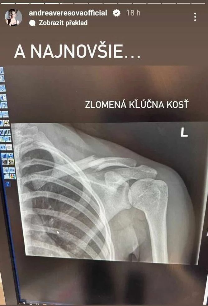 Možná už nikdy nebude chodit Možná už nikdy nebude chodit