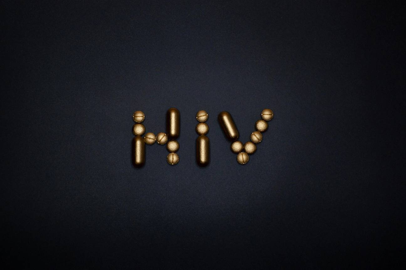 HIV v Česku je na vzestupu. Virus neohrožuje jen gaye, říká odborník