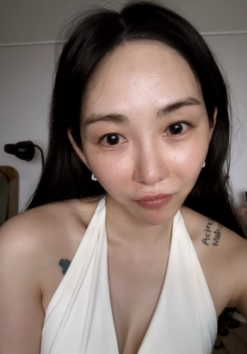 Kwon Mina shares burn recovery update
