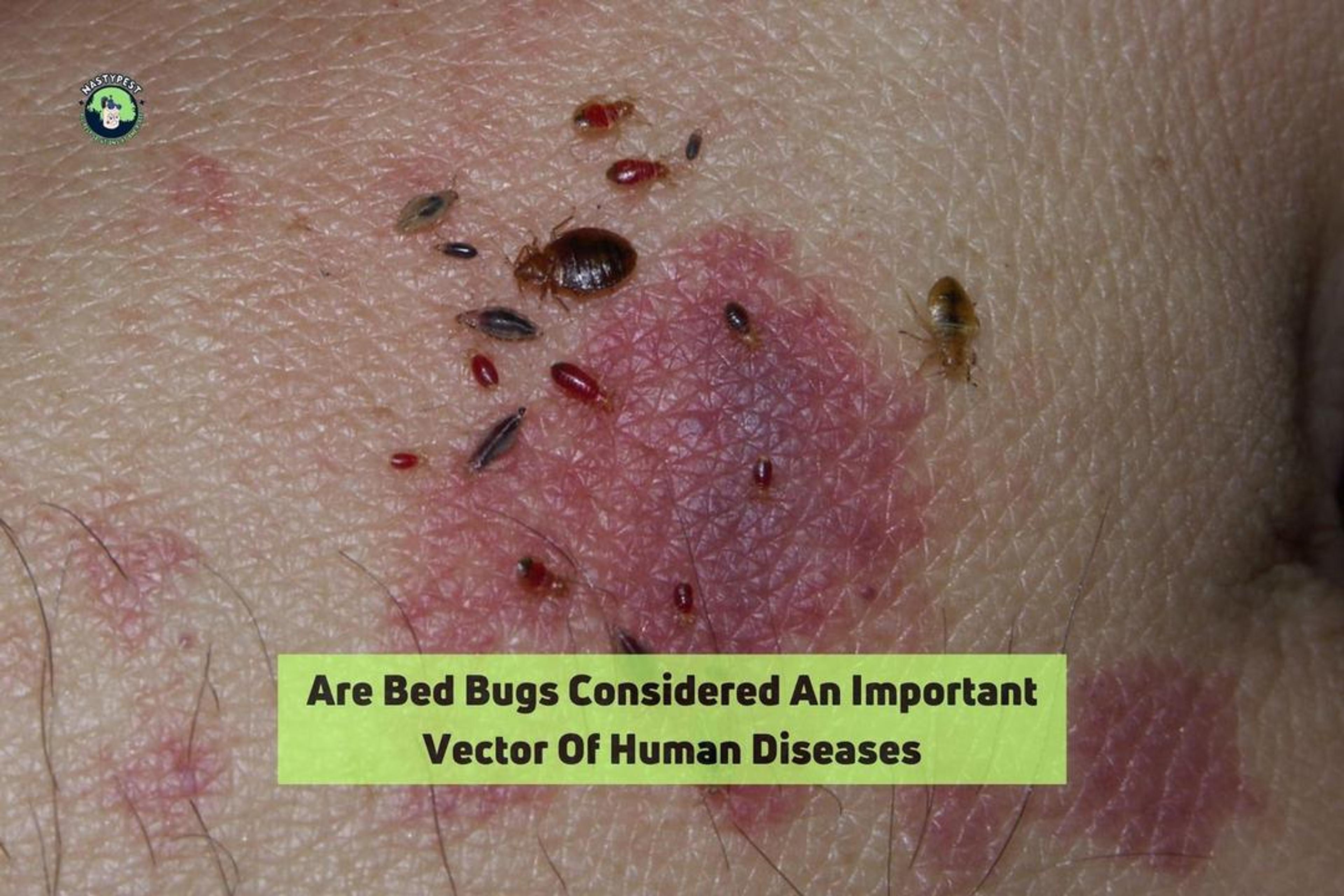 Are Bed Bugs Considered An Important Vector Of Human Diseases