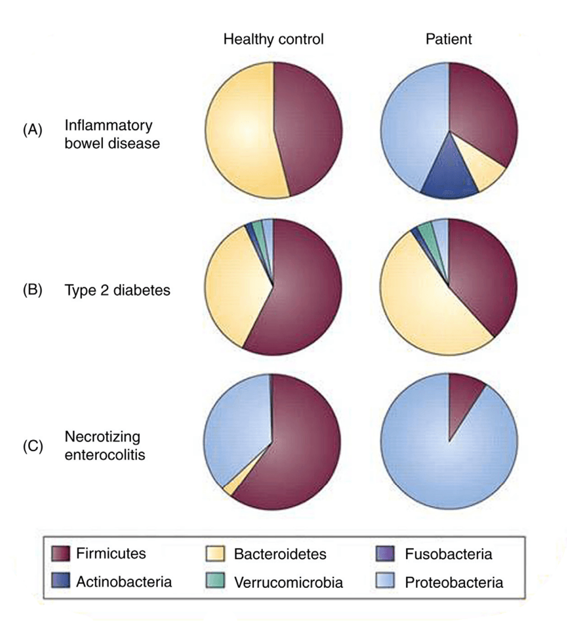 Pie charts comparing gut bacteria phyla in healthy controls and in patients with inflammatory bowel disease, type 2 diabetes and necrotizing enterocolitis