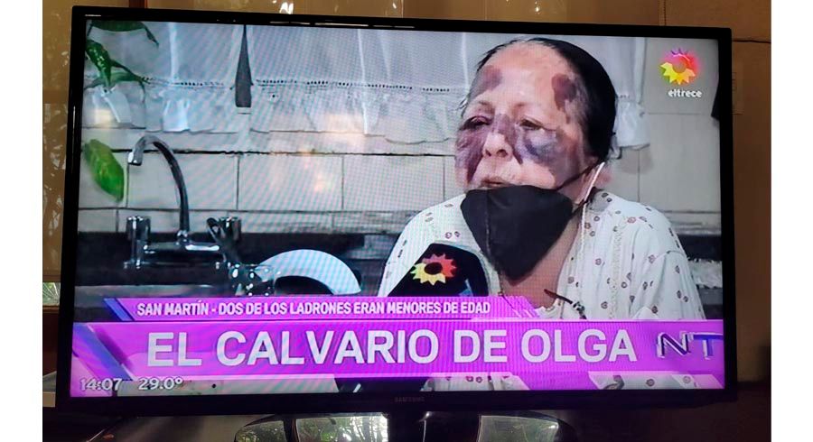 Asalto y golpiza a una vecina de 70 años en San Martín