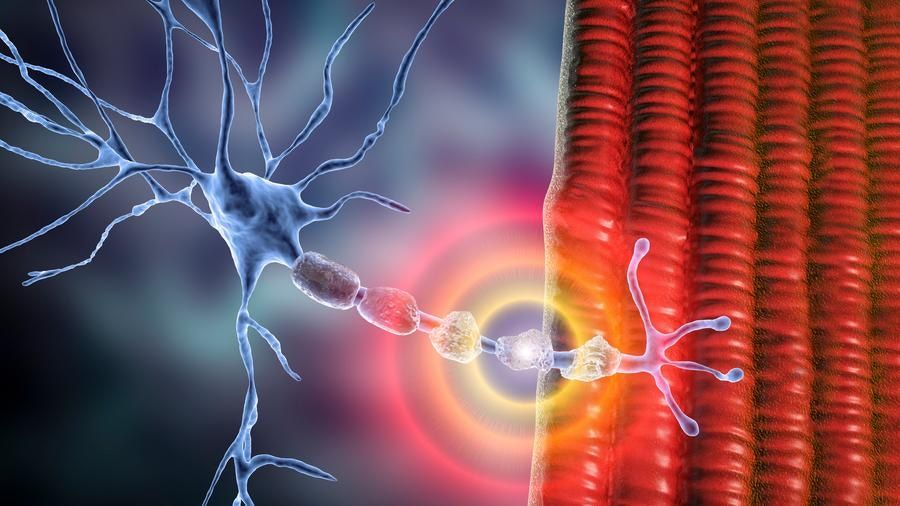 Graphic showing damaged nerve as happens in peripheral neuropathy