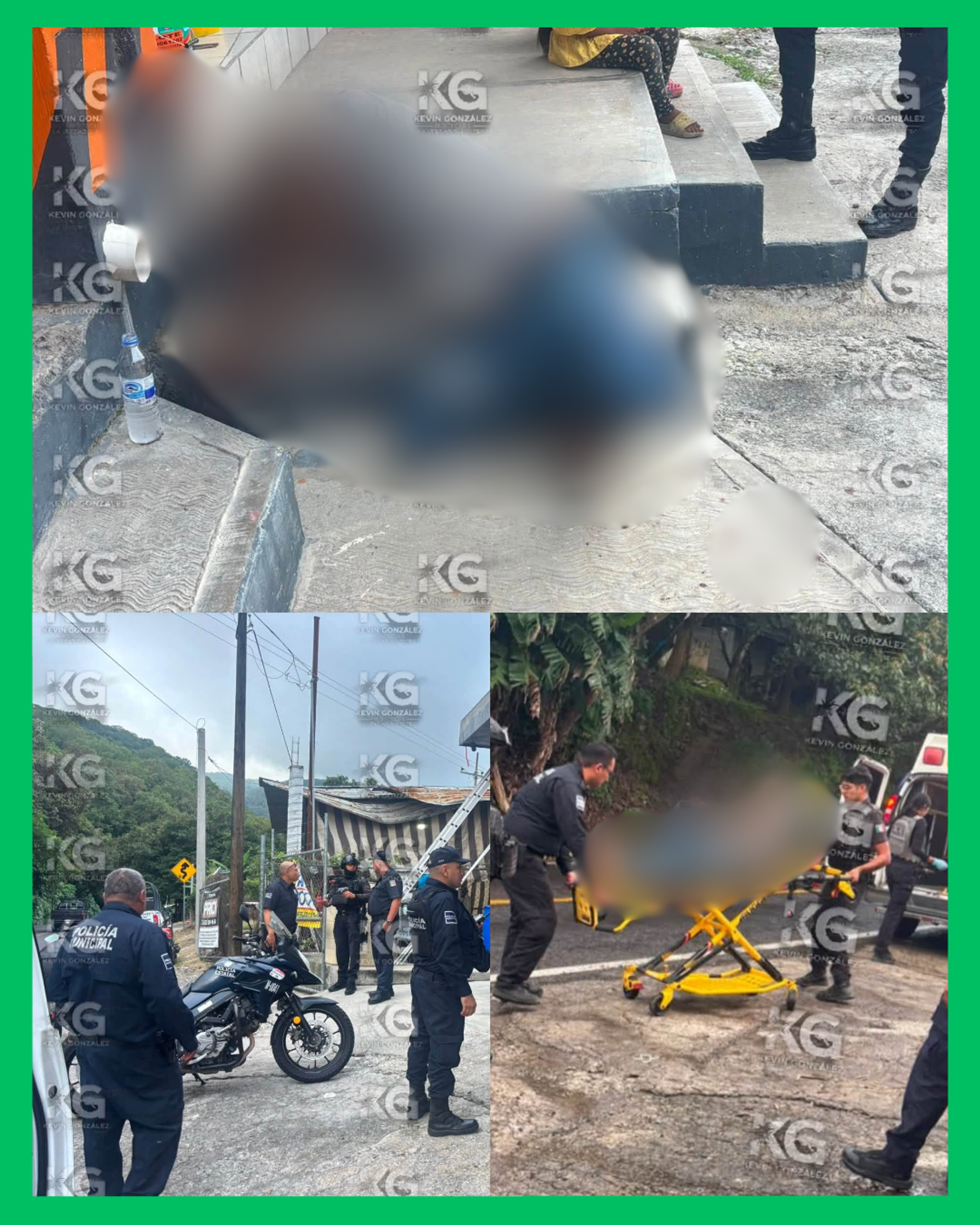  ¡HOMBRE RESULTA LESIONADO POR SU PROPIO HIJASTRO CON UN MACH3TE EN EL IZOTE! 