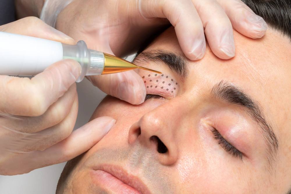 Plazma Age Treatment