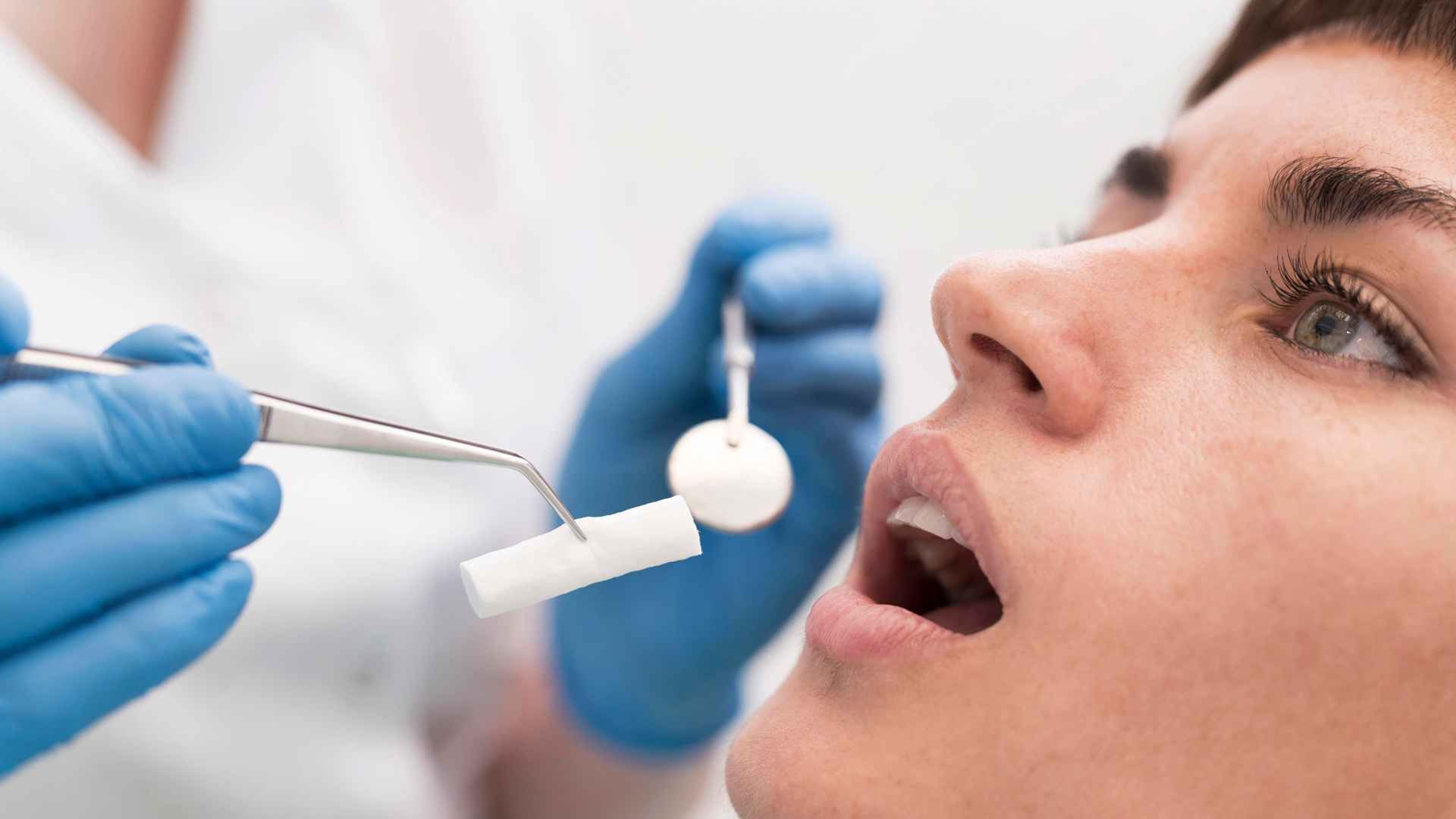 Apicectomía: Qué es, cuándo se necesita y cómo es la recuperación