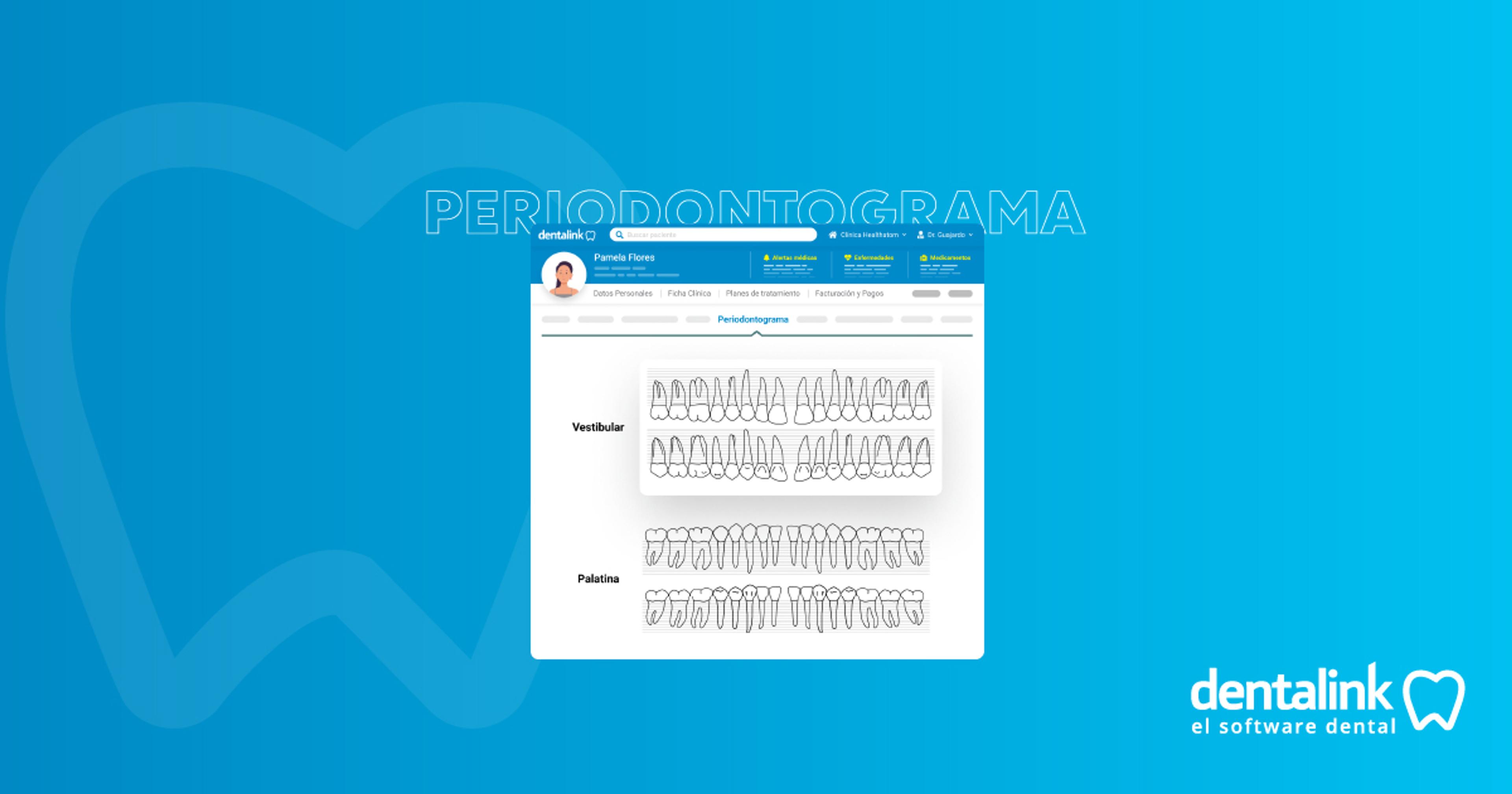¿Qué es un periodontograma digital?