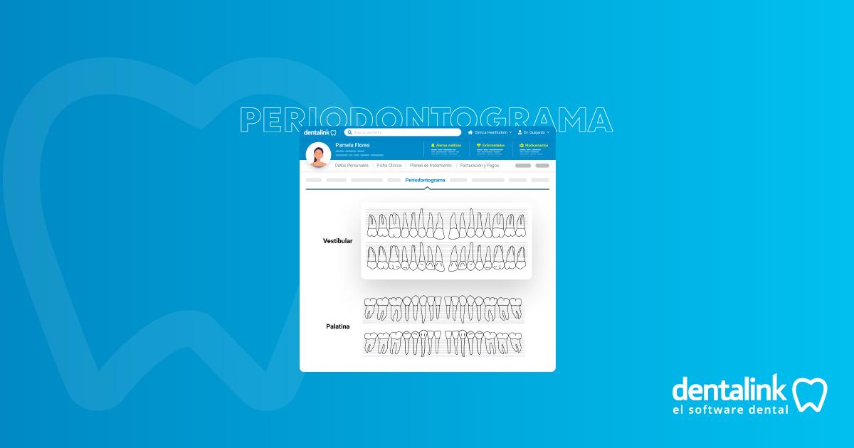 ¿Qué es un periodontograma digital?