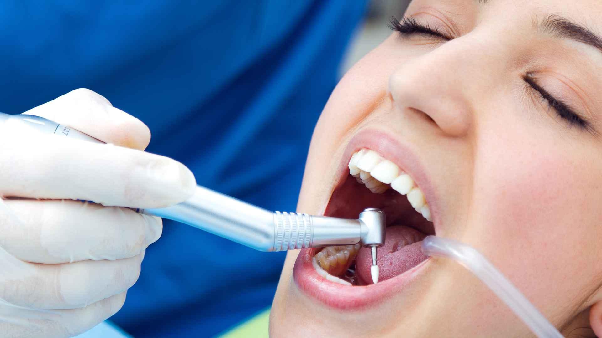 Remineralización dental: qué es, cómo funciona y por qué es clave para los pacientes