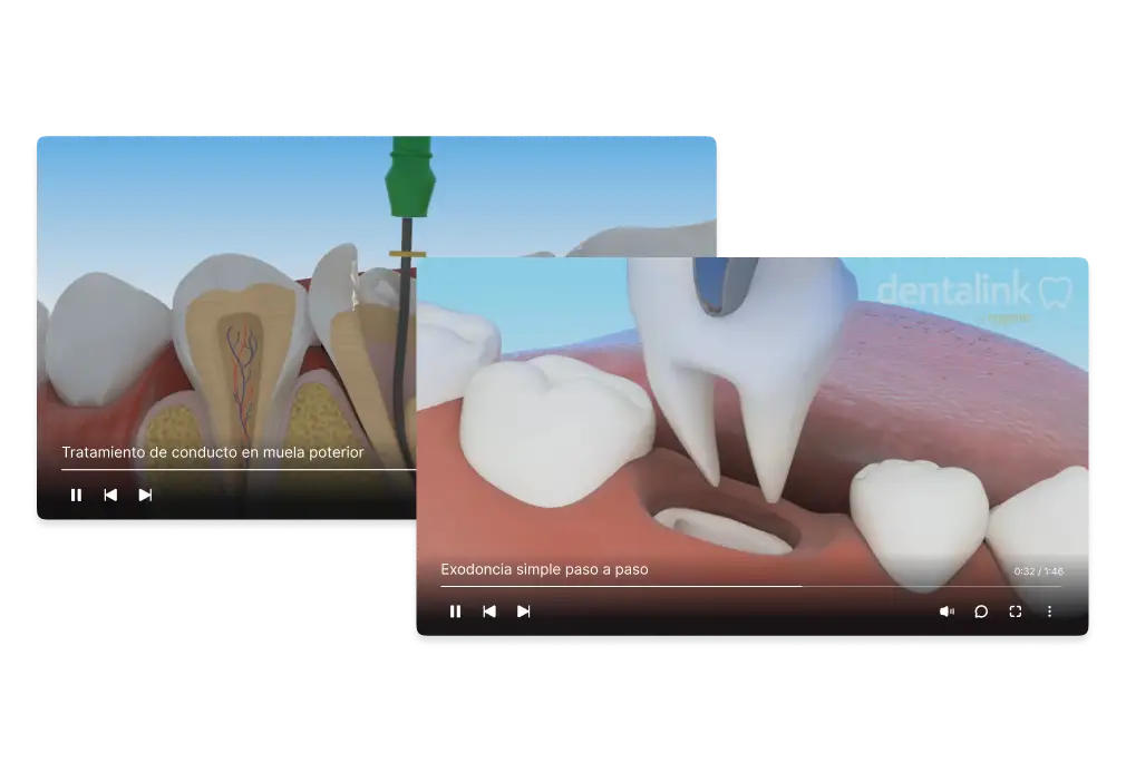 Video educativo 3D de un tratamiento odontológico en Dentalink