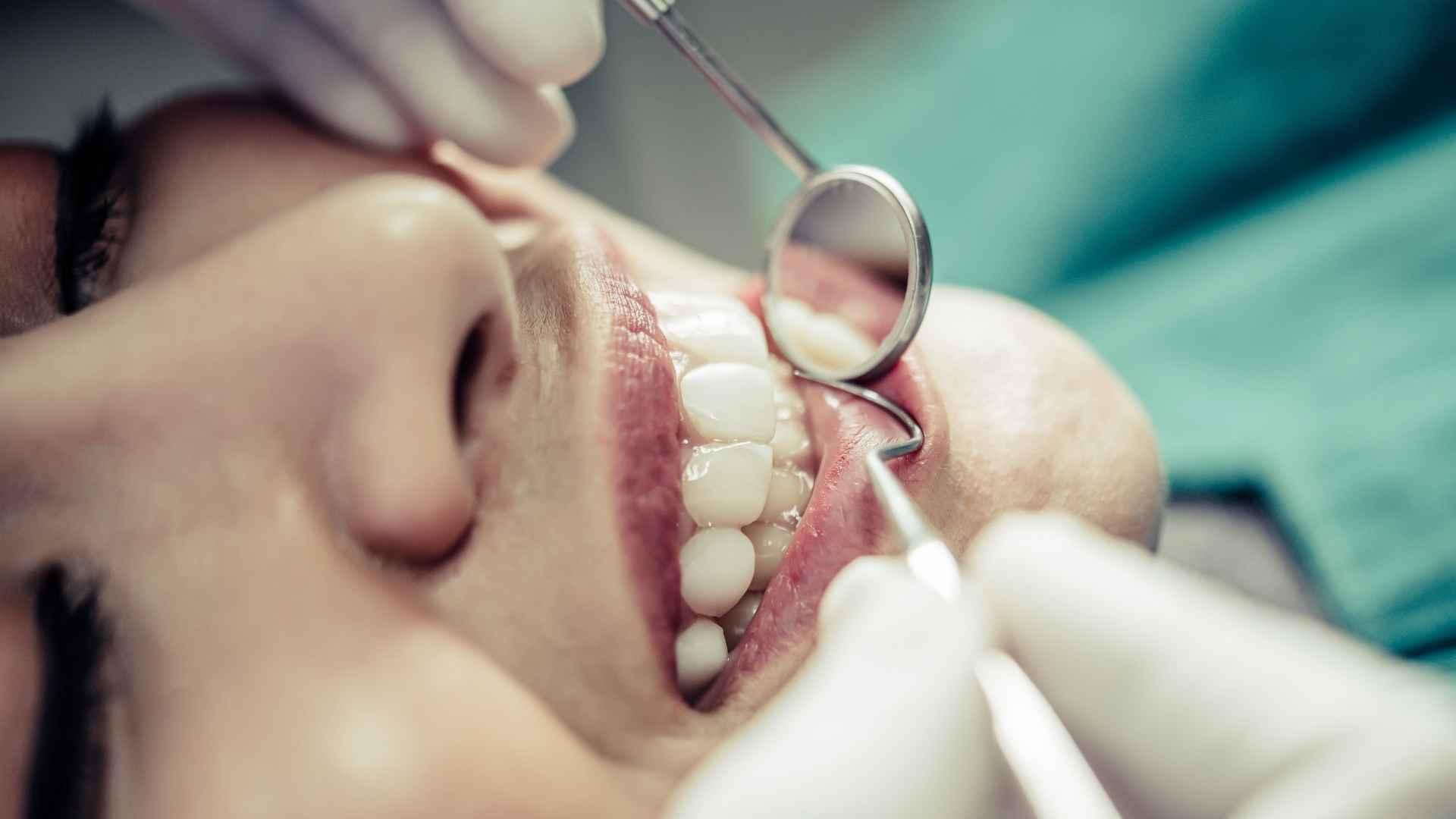 Odontoplastia: qué es, cuándo está indicada y cómo registrarla en tu clínica