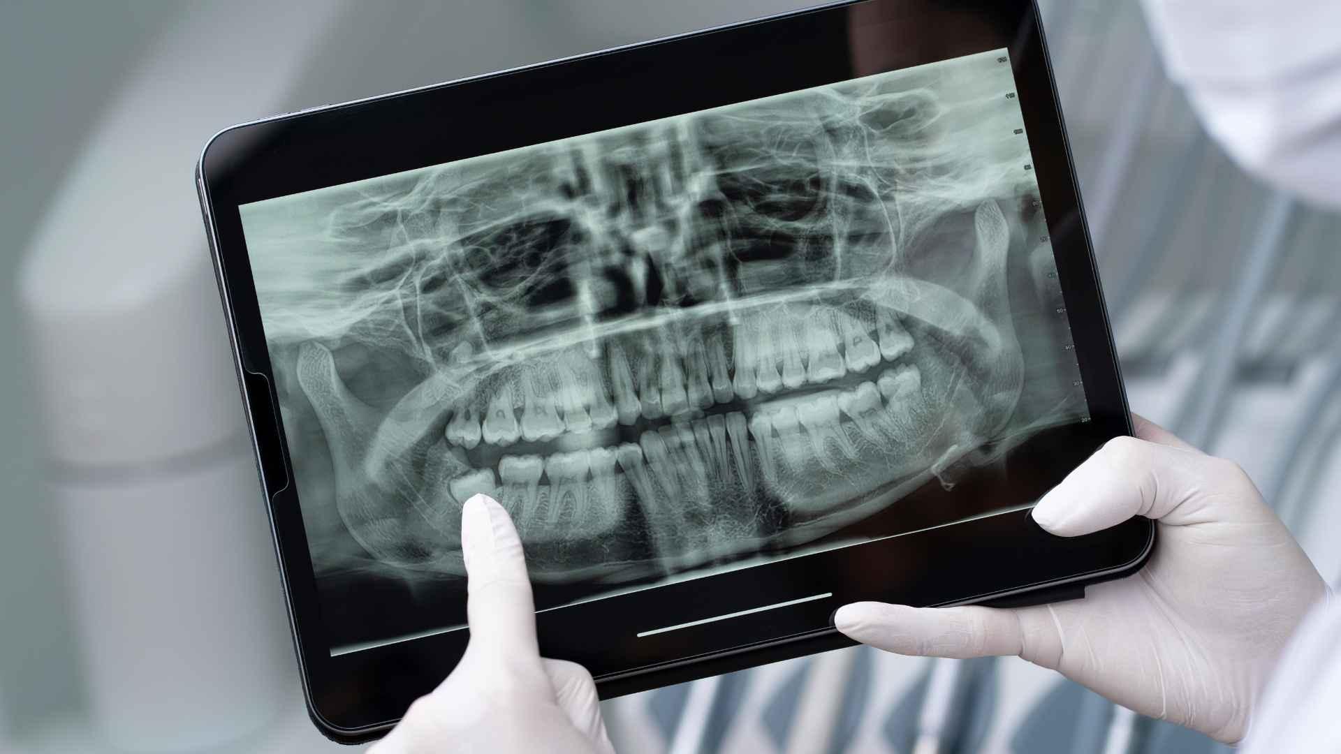 Periodontograma online: qué es, cómo funciona y por qué es clave en la odontología moderna