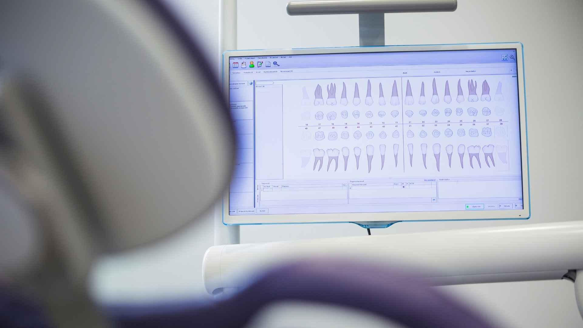 Diagrama dental: qué es, para qué sirve y cómo se usa en odontología moderna