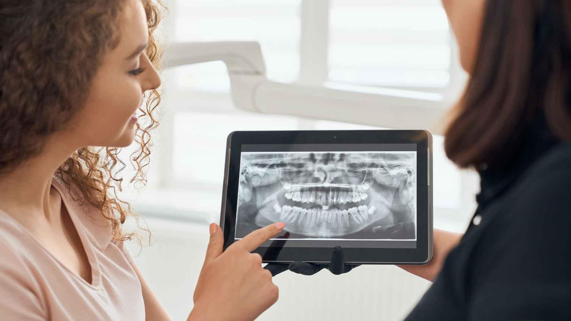 Fotografías Intraorales: Qué son, para qué sirven y cómo usarlas en odontología