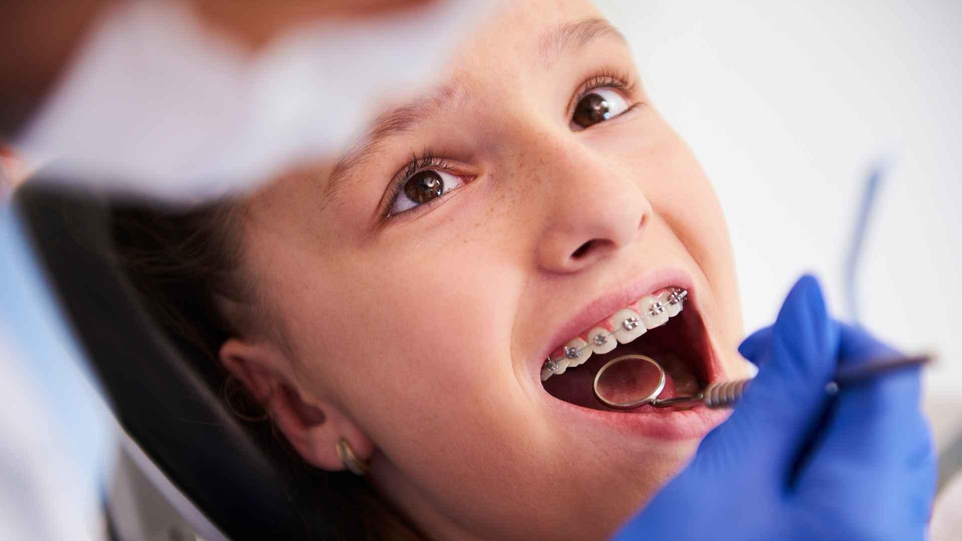 Biotipos faciales: Guía completa para entender la clasificación y su importancia en ortodoncia