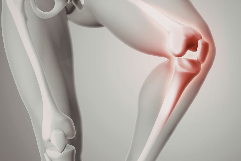 Bursitis en rodilla: causas, síntomas y tratamiento con fisioterapia | Clínica Recupérate en Salamanca